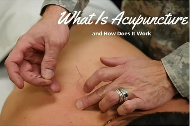 What Is Acupuncture and How Does It Work