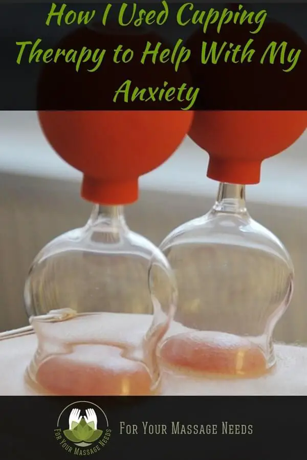 Cupping for Anxiety